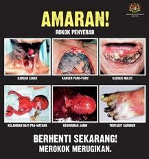 Poster amaran kesihatan: rokok penyebab kanser leher, paru-paru, mulut, kelahiran pramatang, keguguran dan gangren